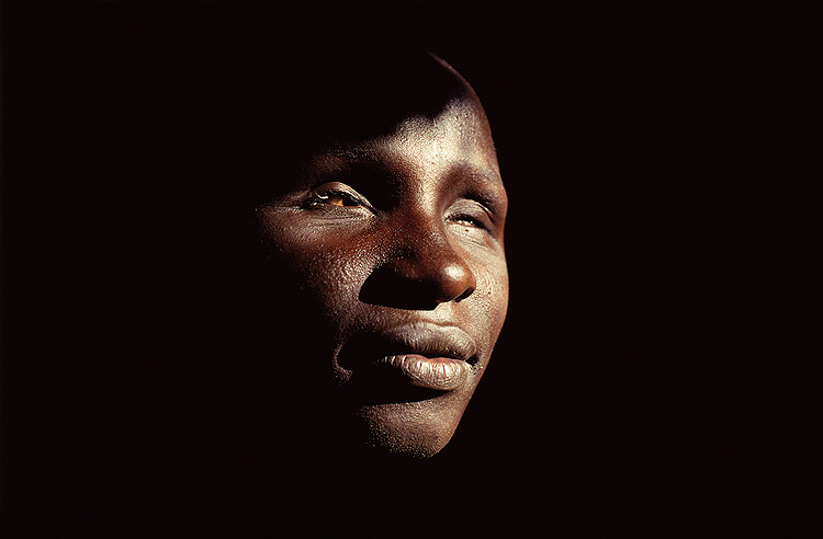 Trachoma Victim, Tanzania, 1991