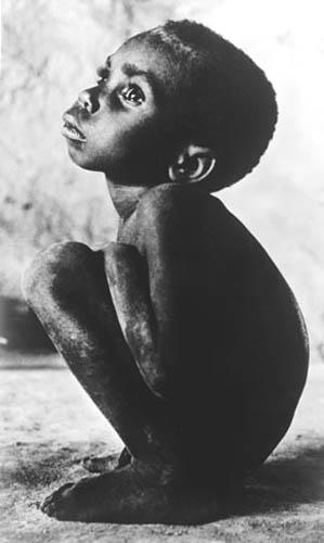 Photo: Starvation, Haiti, 1976 Vintage Gelatin Silver Print #371